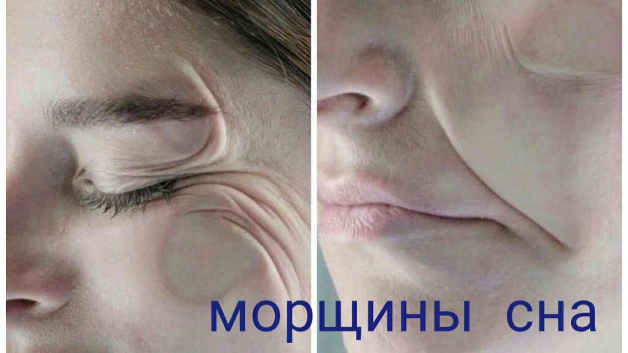 5 способов предотвратить появление морщин во время сна 5 способов предотвратить появление морщин во время сна